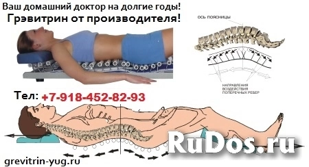 Лечение s-образного сколиоза позвоночника. Тренажер Грэвитрин изображение 3