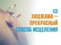 Хиджама на выезд в объявлении 2 фото Хиджама на выезд картинка из объявления
