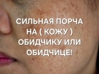 ЧЁРНАЯ МАГИЯ! ПОРЧА ( НА КОЖУ ОБИДЧИКУ ИЛИ ОБИДЧИЦЕ )! ЖАБЬЯ ПОРЧА! картинка из объявления